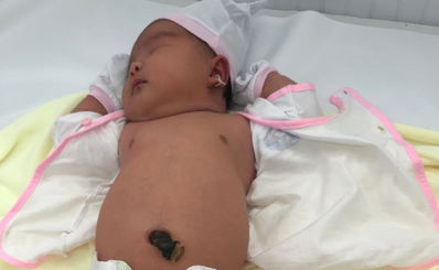 TTO - Bệnh viện quận 11 đón bé gái chào đời nặng 5,2kg