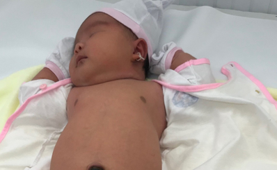 (Dân sinh) Lần đầu tiên bệnh viện Quận 11 đỡ đẻ thành công cho sản phụ sinh con nặng 5,2kg
