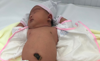 (Tầm nhìn) TP.HCM: Bệnh viện Quận 11 đón bé gái chào đời nặng 5,2kg